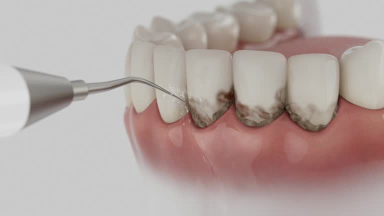Trusted Emergency Dentist service in Pocasset, MA - Dentist Open Now